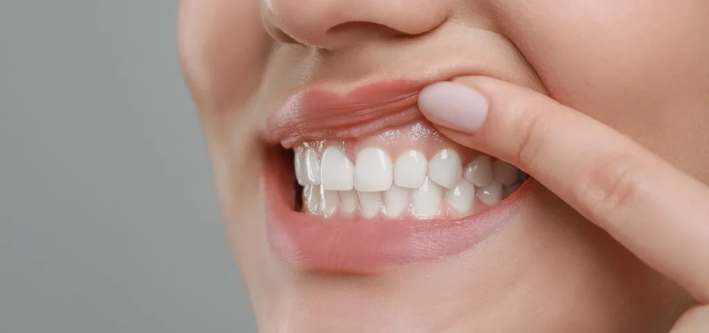 soins gencives Soins dentaires Cabinet CDA | Chirurgiens-dentistes à Alby-sur-Chéran