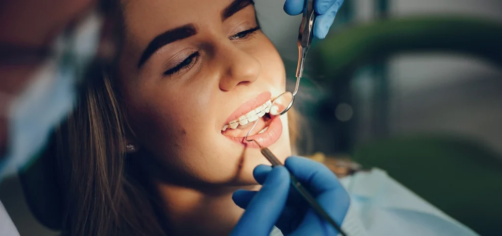 bagues dentaires classiques Orthodontie Cabinet CDA | Chirurgiens-dentistes à Alby-sur-Chéran