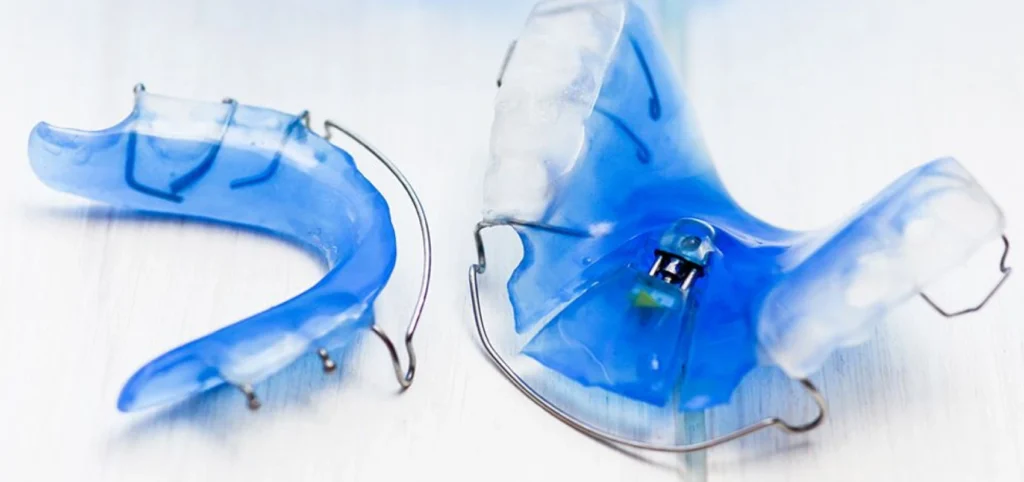 plaque palatine enfants Orthodontie Cabinet CDA | Chirurgiens-dentistes à Alby-sur-Chéran