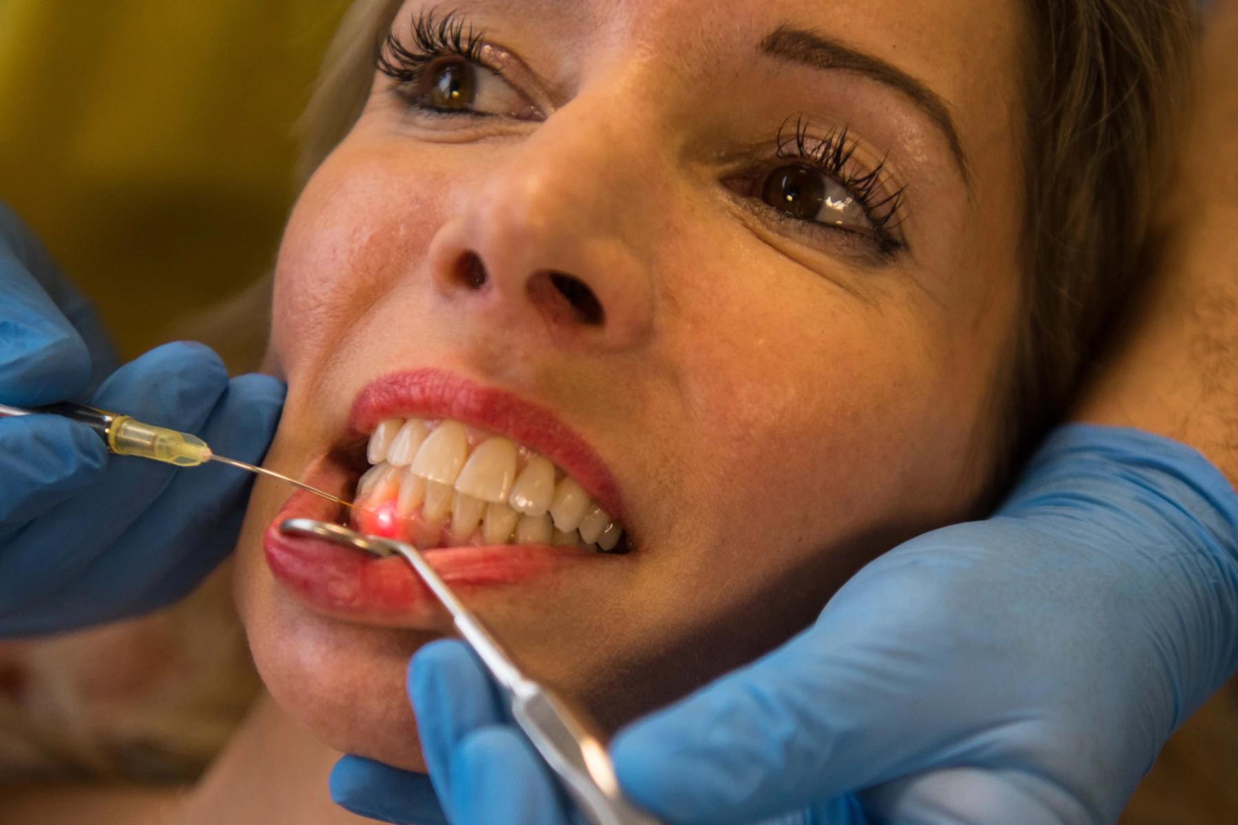 implanta chirurgie orale laser dentaire